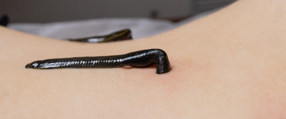 hirudoterapia-terapia-pijawkami-rzeszow